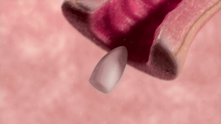 Bonafide motion study 1